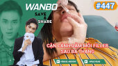 Chương Trình WANBO SAVE & SHARE Tập 447 : Cận Cảnh Dặm Môi Filler Sau Ba Tháng