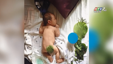 Xem Clip Bị Bỏng Nặng Vì Đắp Lá Trầu HD Online.