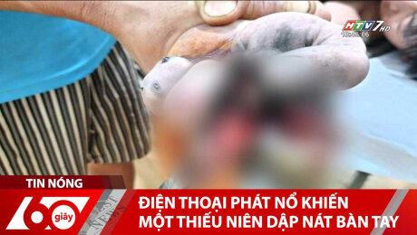 Xem Clip Điện Thoại Phát Nổ Khiến Một Thiếu Niên Dập Nát Bàn Tay HD Online.