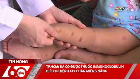 Xem Clip TP.HCM: ĐÃ CÓ ĐƯỢC THUỐC IMMUNOGLOBULIN ĐIỀU TRỊ BỆNH TAY CHÂN MIỆNG NẶNG HD Online.